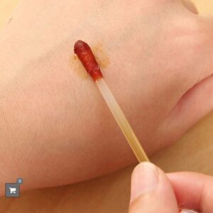 hisopo (10) con iodo Alcohol médico desechable desinfectar campamento paramedico